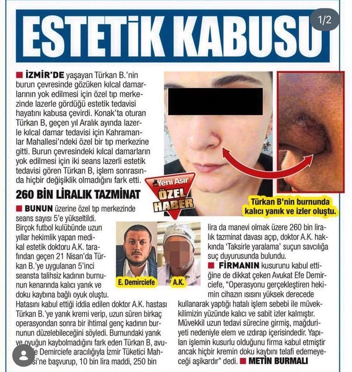 Yeni Asır gazetesinde yayımlanan haber: Estetik operasyonda kalıcı iz kalırsa hastanın hakları nelerdir?